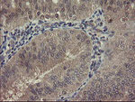CHN1 Antibody in Immunohistochemistry (Paraffin) (IHC (P))
