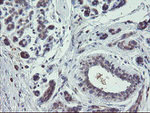 CHN1 Antibody in Immunohistochemistry (Paraffin) (IHC (P))