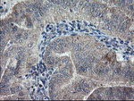 CHN1 Antibody in Immunohistochemistry (Paraffin) (IHC (P))