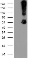 CHN1 Antibody in Western Blot (WB)