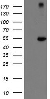 CHN1 Antibody in Western Blot (WB)