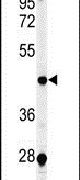CHN2 Antibody in Western Blot (WB)