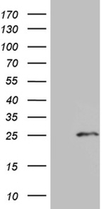 CHP1 Antibody in Western Blot (WB)