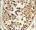 CHPF Antibody in Immunohistochemistry (IHC)