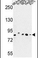 CHPF Antibody in Western Blot (WB)