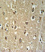 CHRNA3 Antibody in Immunohistochemistry (IHC)