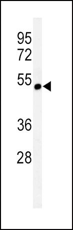 CHRNA3 Antibody in Western Blot (WB)