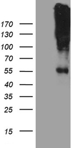 CHRNA5 Antibody in Western Blot (WB)