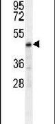 CHST2 Antibody in Western Blot (WB)