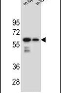 CHST3 Antibody in Western Blot (WB)