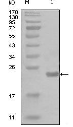 IKK alpha Monoclonal Antibody (7C10B6, 1A10A10)