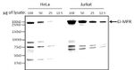 IGF2R Antibody in Western Blot (WB)
