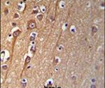 CI091 Antibody in Immunohistochemistry (IHC)