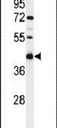 CI091 Antibody in Western Blot (WB)