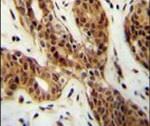 LURAP1L Antibody in Immunohistochemistry (IHC)