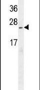 LURAP1L Antibody in Western Blot (WB)