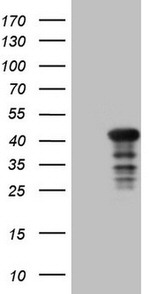 CIAPIN1 Antibody in Western Blot (WB)