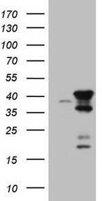 CIAPIN1 Antibody in Western Blot (WB)