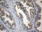 CIB1 Antibody in Immunohistochemistry (Paraffin) (IHC (P))