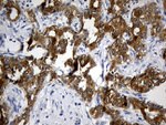 CIB1 Antibody in Immunohistochemistry (Paraffin) (IHC (P))