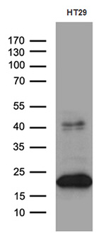 CIB1 Antibody in Western Blot (WB)