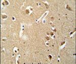 CILP2 Antibody in Immunohistochemistry (IHC)