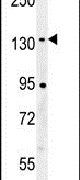 CILP2 Antibody in Western Blot (WB)