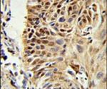 CIRBP Antibody in Immunohistochemistry (IHC)