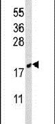 CIRBP Antibody in Western Blot (WB)