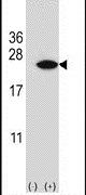 CIRBP Antibody in Western Blot (WB)