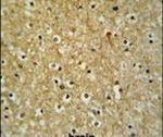 CIRH1A Antibody in Immunohistochemistry (IHC)