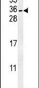 CITED2 Antibody in Western Blot (WB)