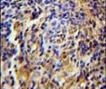 C11orf73 Antibody in Immunohistochemistry (IHC)