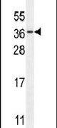 C11orf73 Antibody in Western Blot (WB)