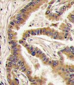 CK1 alpha Antibody in Immunohistochemistry (IHC)