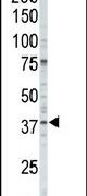 CK1 alpha Antibody in Western Blot (WB)