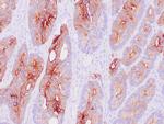 Cytokeratin 20 Antibody in Immunohistochemistry (Paraffin) (IHC (P))