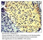 Cytokeratin 7 Antibody in Immunohistochemistry (IHC)