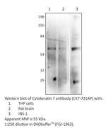 Cytokeratin 7 Antibody in Western Blot (WB)