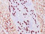 Cytokeratin 8 Antibody in Immunohistochemistry (Paraffin) (IHC (P))