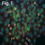 CK1 alpha Antibody in Immunocytochemistry (ICC/IF)