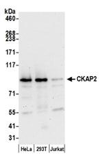 CKAP2 Antibody in Western Blot (WB)