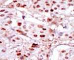 CK2 alpha-1 Antibody in Immunohistochemistry (IHC)
