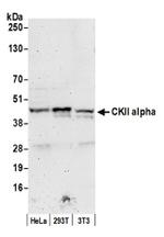 CKII alpha Polyclonal Antibody
