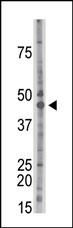 CK2 alpha-1 Antibody in Western Blot (WB)