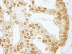 CKII beta Antibody in Immunohistochemistry (IHC)