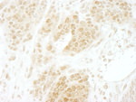 CKII beta Antibody in Immunohistochemistry (IHC)