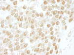 CKII beta Antibody in Immunohistochemistry (IHC)