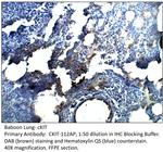 cKit Antibody in Immunohistochemistry (IHC)