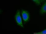 MEF2C Antibody in Immunocytochemistry (ICC/IF)